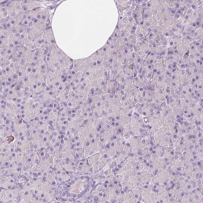 A2BP1 Antibody - BSA Free Immunohistochemistry: A2BP1 Antibody - BSA Free [NBP1-90304]