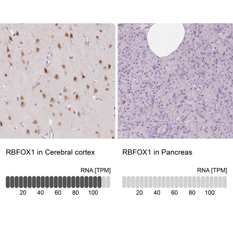 A2BP1 Antibody - BSA Free Immunohistochemistry: A2BP1 Antibody - BSA Free [NBP1-90304]