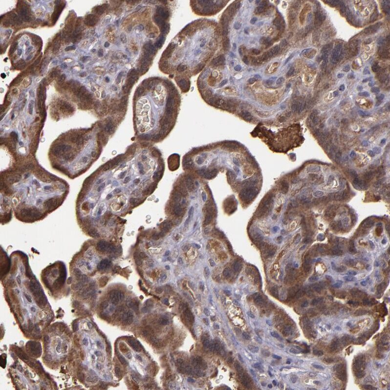 Serpin F2/alpha 2-Antiplasmin Antibody - BSA Free Immunohistochemistry: Serpin F2/alpha 2-Antiplasmin Antibody - BSA Free [NBP1-90305]