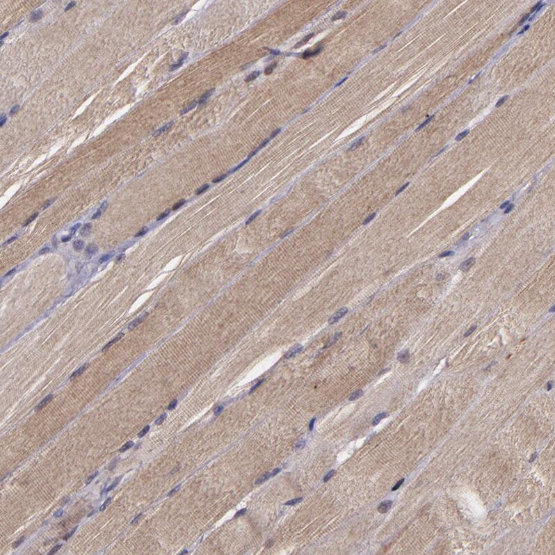 Serpin F2/alpha 2-Antiplasmin Antibody - BSA Free Immunohistochemistry: Serpin F2/alpha 2-Antiplasmin Antibody - BSA Free [NBP1-90305]