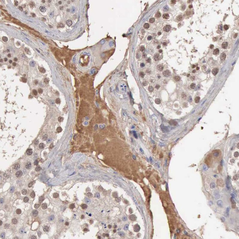 Serpin A1/alpha 1-Antitrypsin Antibody - BSA Free Immunohistochemistry: Serpin A1/alpha 1-Antitrypsin Antibody - BSA Free [NBP1-90309]