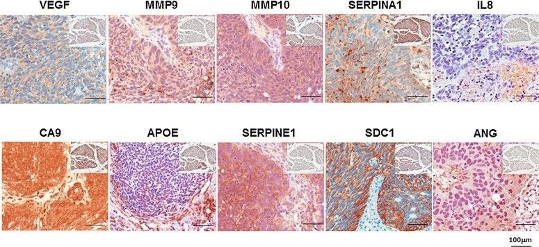 Serpin A1/alpha 1-Antitrypsin Antibody