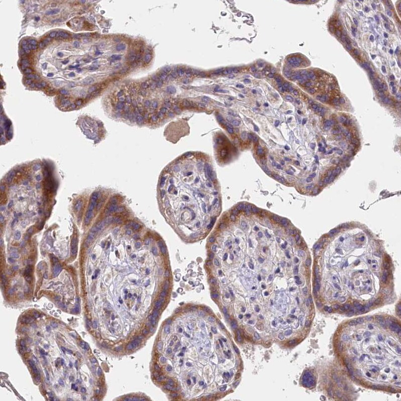 Protein O-Glucosyltransferase 1/POGLUT1/KTELC1 Antibody - BSA Free Immunohistochemistry: Protein O-Glucosyltransferase 1/POGLUT1/KTELC1 Antibody - BSA Free [NBP1-90311]