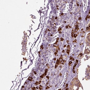 Secretogranin V Antibody - BSA Free Immunohistochemistry: Secretogranin V Antibody - BSA Free [NBP1-90312]