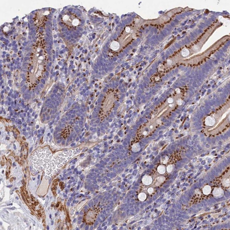 GCP4 Antibody - BSA Free Immunohistochemistry: GCP4 Antibody - BSA Free [NBP1-90313]