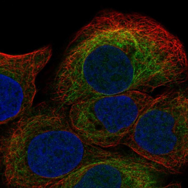 S100A8 Antibody - BSA Free Immunocytochemistry/ Immunofluorescence: S100A8 Antibody - BSA Free [NBP1-90314]