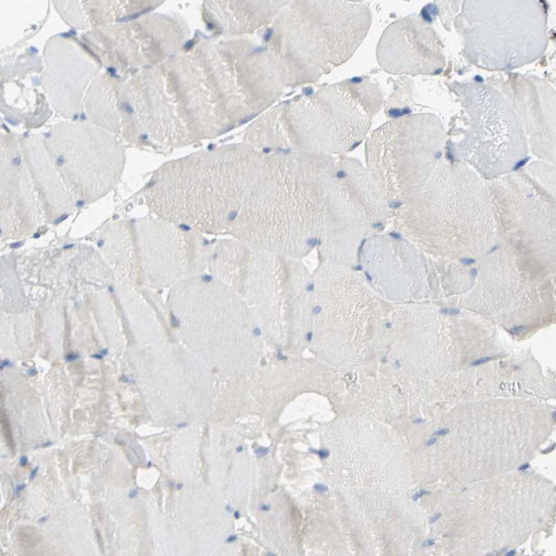 5-HT1F Antibody - BSA Free Immunohistochemistry: 5-HT1F Antibody - BSA Free [NBP1-90319]