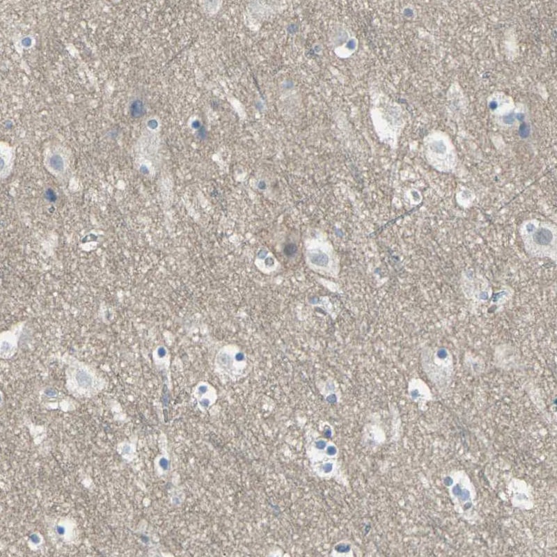 5-HT1F Antibody - BSA Free Immunohistochemistry: 5-HT1F Antibody - BSA Free [NBP1-90319]