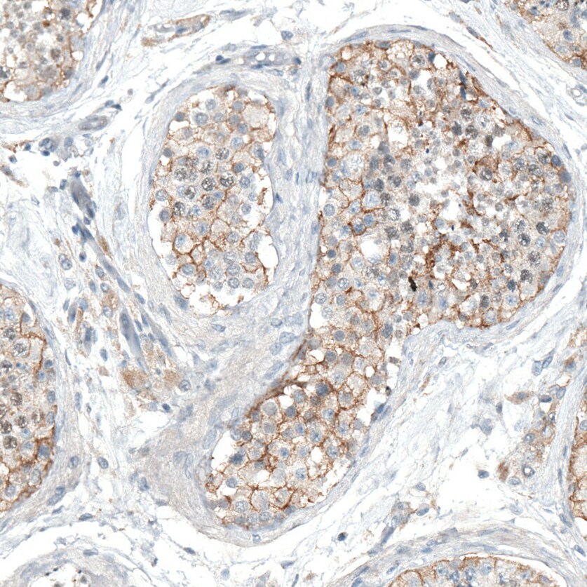 5-HT1E Antibody - BSA Free Immunohistochemistry: 5-HT1E Antibody - BSA Free [NBP1-90320]