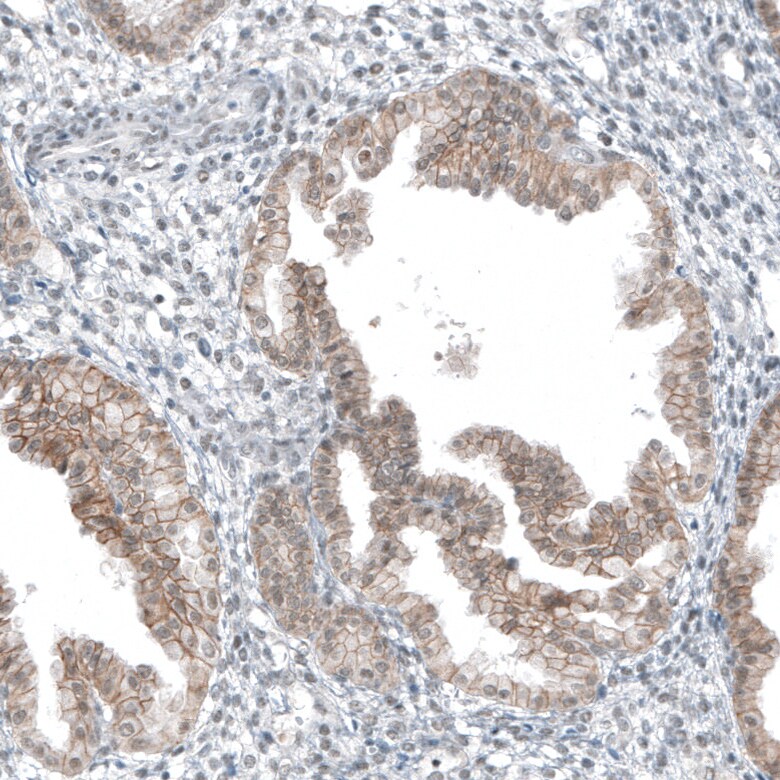 5-HT1E Antibody - BSA Free Immunohistochemistry: 5-HT1E Antibody - BSA Free [NBP1-90320]