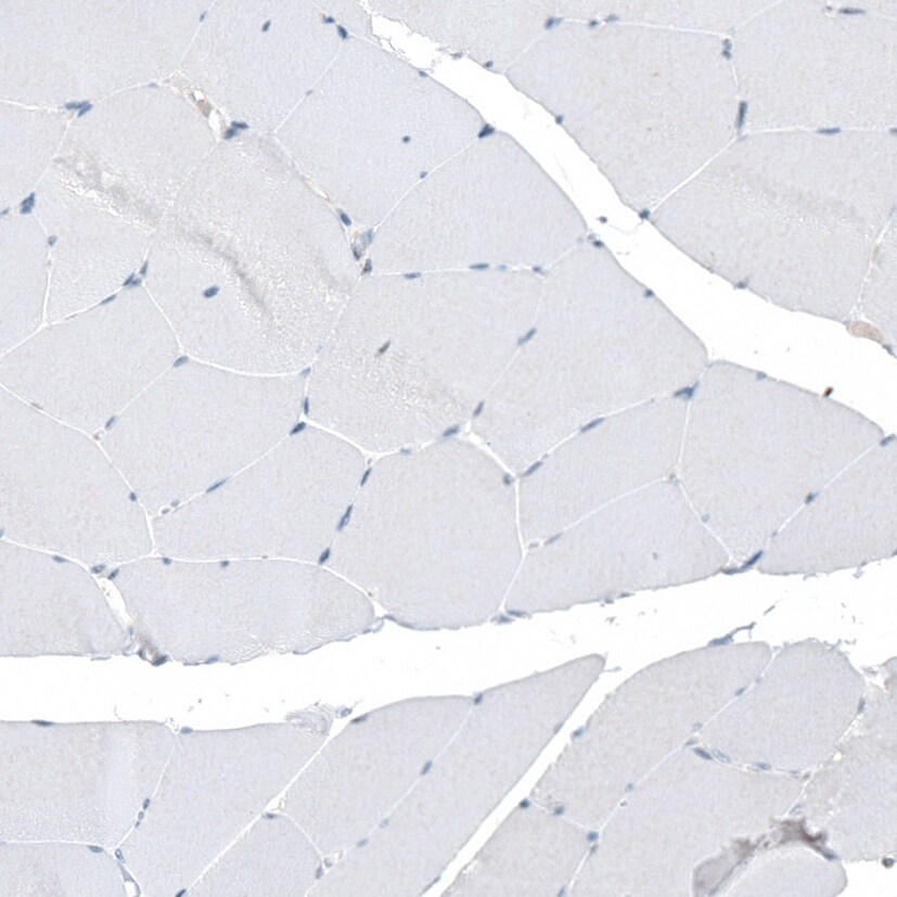 5-HT1E Antibody - BSA Free Immunohistochemistry: 5-HT1E Antibody - BSA Free [NBP1-90320]