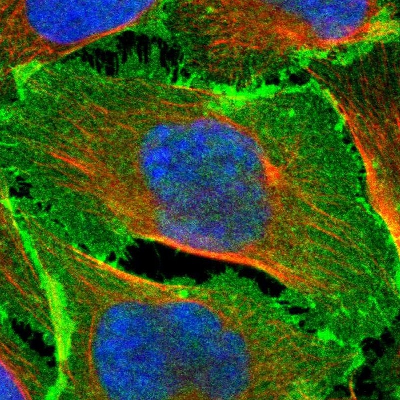 EPB4IL2 Antibody - BSA Free Immunocytochemistry/ Immunofluorescence: EPB4IL2 Antibody [NBP1-90326]