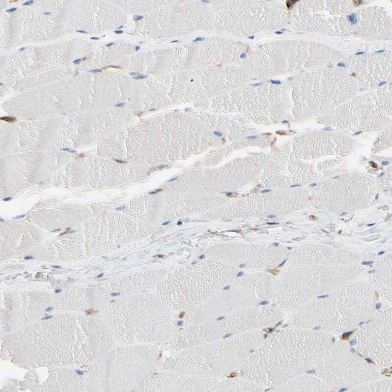 EPB4IL2 Antibody - BSA Free Immunohistochemistry: EPB4IL2 Antibody - BSA Free [NBP1-90326]