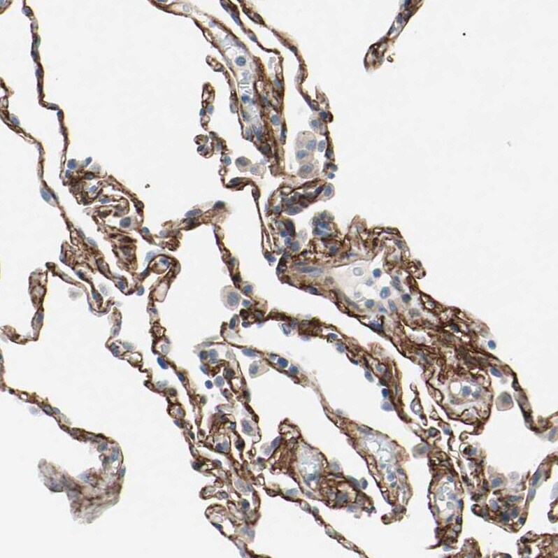 EPB4IL2 Antibody - BSA Free Immunohistochemistry: EPB4IL2 Antibody - BSA Free [NBP1-90326]