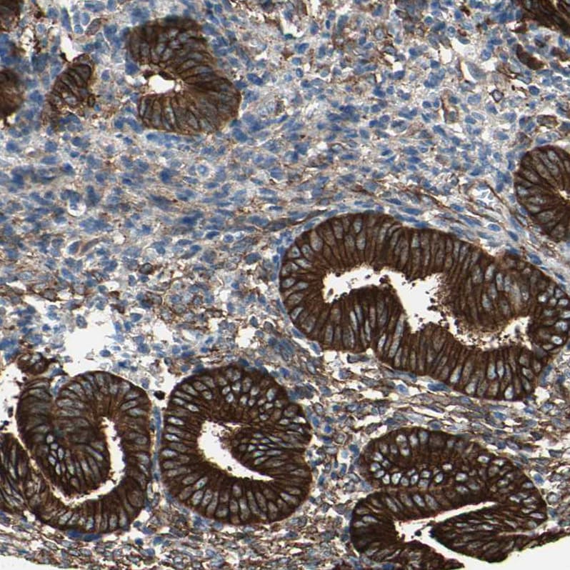 EPB4IL2 Antibody - BSA Free Immunohistochemistry: EPB4IL2 Antibody - BSA Free [NBP1-90326]