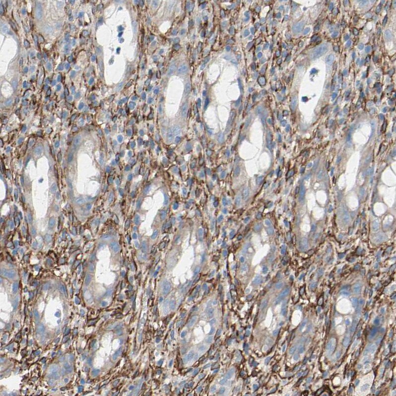 EPB4IL2 Antibody - BSA Free Immunohistochemistry: EPB4IL2 Antibody - BSA Free [NBP1-90326]