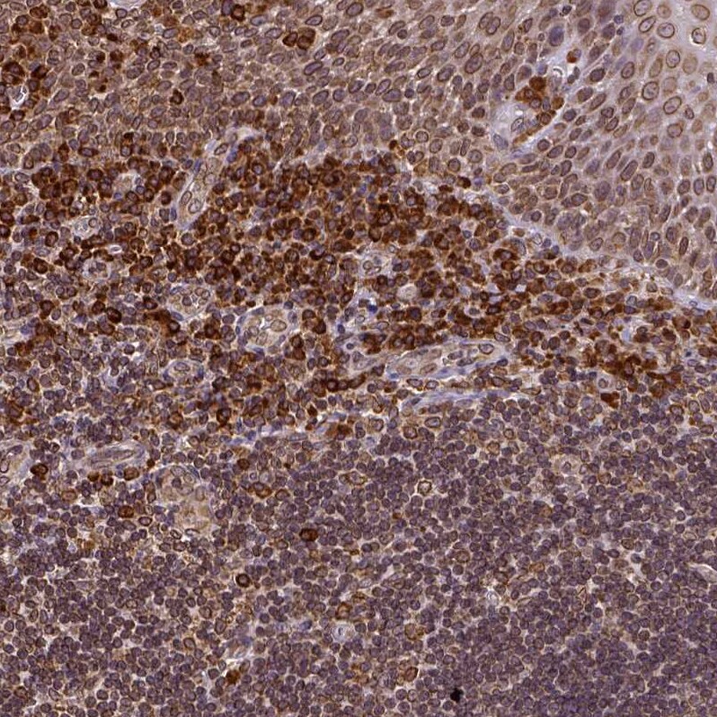 Metadherin Antibody - BSA Free Immunohistochemistry: Metadherin Antibody - BSA Free [NBP1-90327]