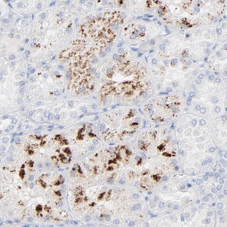 Lipocalin-2/NGAL Antibody - BSA Free Immunohistochemistry: Lipocalin-2/NGAL Antibody - BSA Free [NBP1-90331]