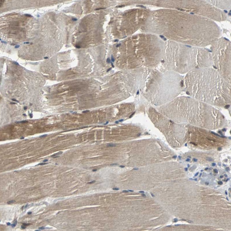 Peroxiredoxin 6 Antibody - BSA Free Immunohistochemistry: Peroxiredoxin 6 Antibody - BSA Free [NBP1-90332]