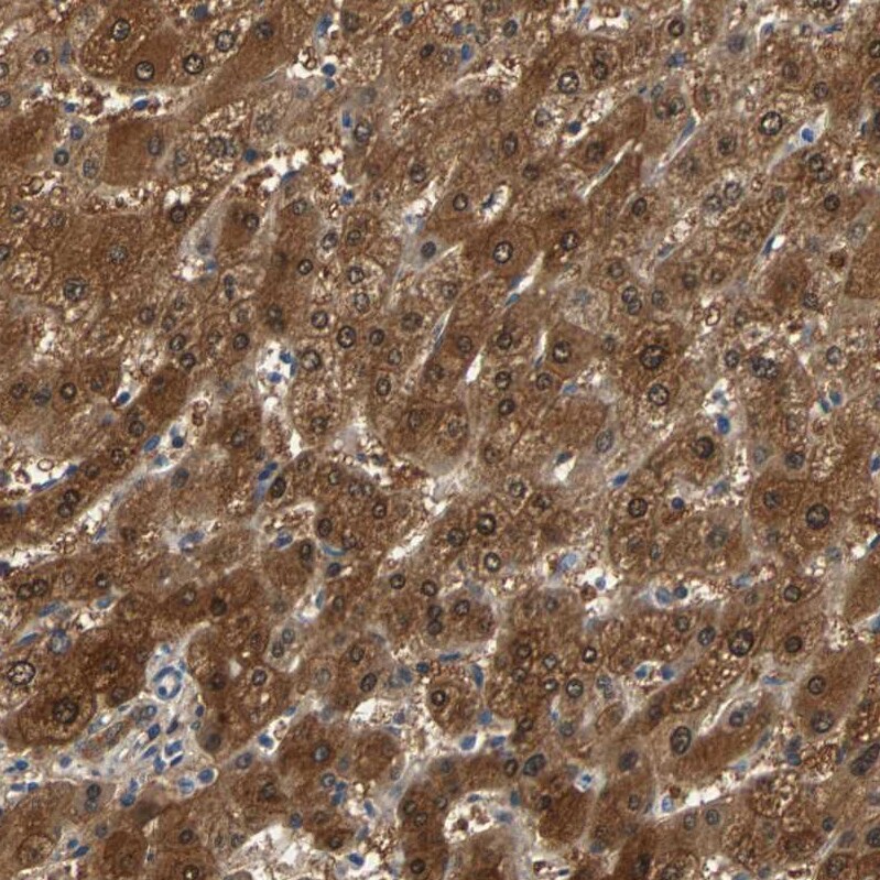 Peroxiredoxin 6 Antibody - BSA Free Immunohistochemistry: Peroxiredoxin 6 Antibody - BSA Free [NBP1-90332]