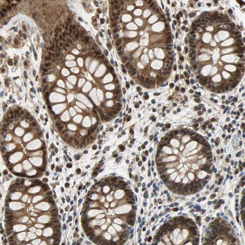 Peroxiredoxin 6 Antibody - BSA Free Immunohistochemistry: Peroxiredoxin 6 Antibody - BSA Free [NBP1-90332]