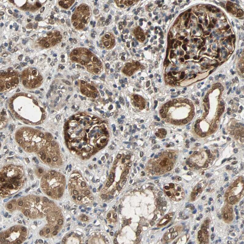 Peroxiredoxin 6 Antibody - BSA Free Immunohistochemistry: Peroxiredoxin 6 Antibody - BSA Free [NBP1-90332]