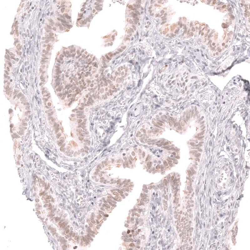 Thyroid receptor-interacting protein 13 Antibody - BSA Free Immunohistochemistry: Thyroid receptor-interacting protein 13 Antibody - BSA Free [NBP1-90335]