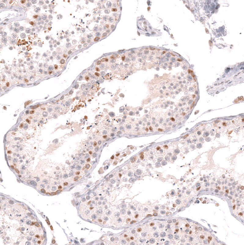 Thyroid receptor-interacting protein 13 Antibody - BSA Free Immunohistochemistry: Thyroid receptor-interacting protein 13 Antibody - BSA Free [NBP1-90335]