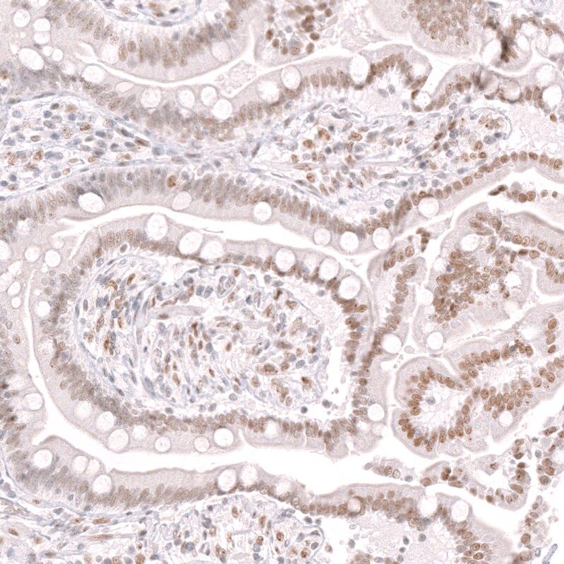 Thyroid receptor-interacting protein 13 Antibody - BSA Free Immunohistochemistry: Thyroid receptor-interacting protein 13 Antibody - BSA Free [NBP1-90335]