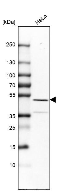 Thyroid receptor-interacting protein 13 Antibody - BSA Free Western Blot: Thyroid receptor-interacting protein 13 Antibody - BSA Free [NBP1-90335]