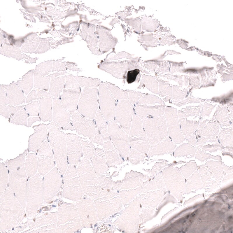 Thyroid receptor-interacting protein 13 Antibody - BSA Free Immunohistochemistry: Thyroid receptor-interacting protein 13 Antibody - BSA Free [NBP1-90335]