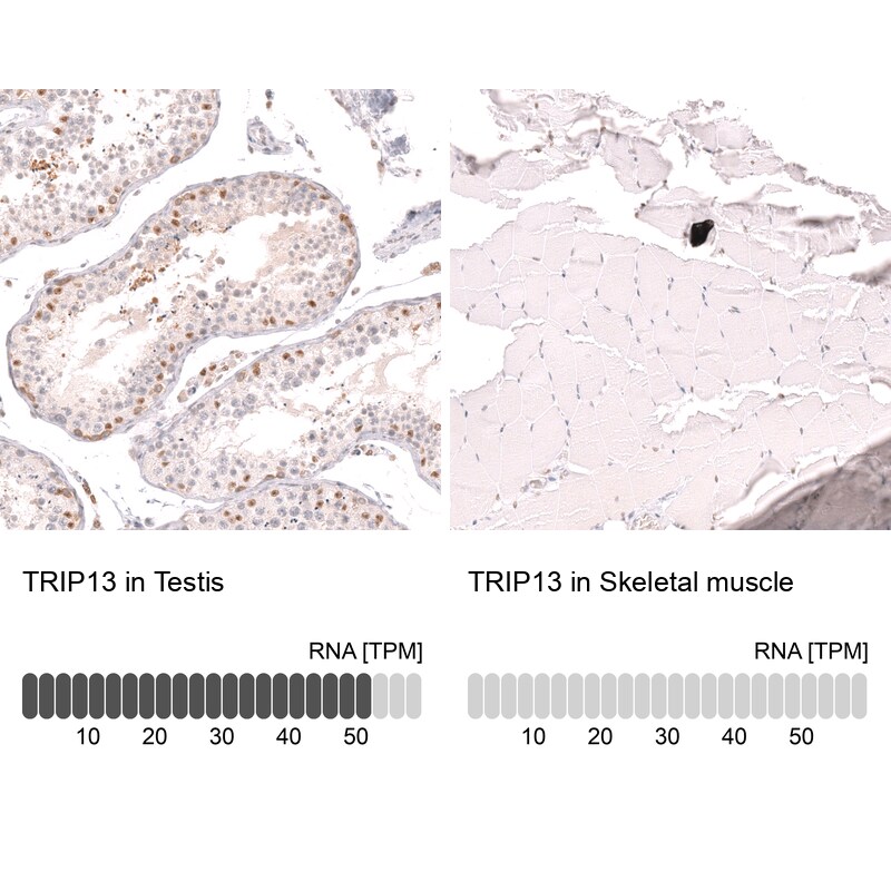 Thyroid receptor-interacting protein 13 Antibody - BSA Free Immunohistochemistry: Thyroid receptor-interacting protein 13 Antibody - BSA Free [NBP1-90335]