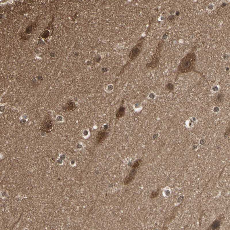 14-3-3 tau/theta Antibody - BSA Free Immunohistochemistry-Paraffin: 14-3-3 tau/theta Antibody [NBP1-90337]
