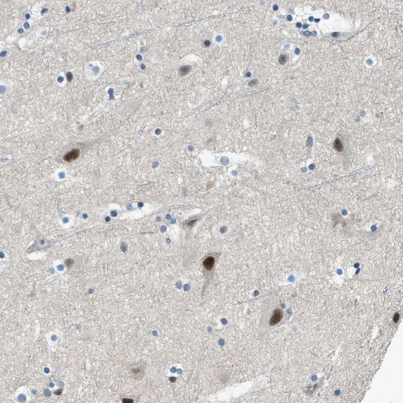Zeta Opioid Receptor Antibody - BSA Free Immunohistochemistry: Zeta Opioid Receptor Antibody - BSA Free [NBP1-90340]