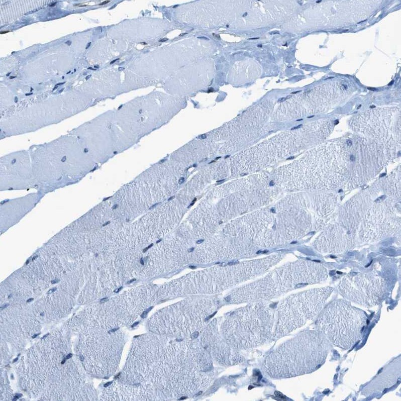Zeta Opioid Receptor Antibody - BSA Free Immunohistochemistry: Zeta Opioid Receptor Antibody - BSA Free [NBP1-90340]