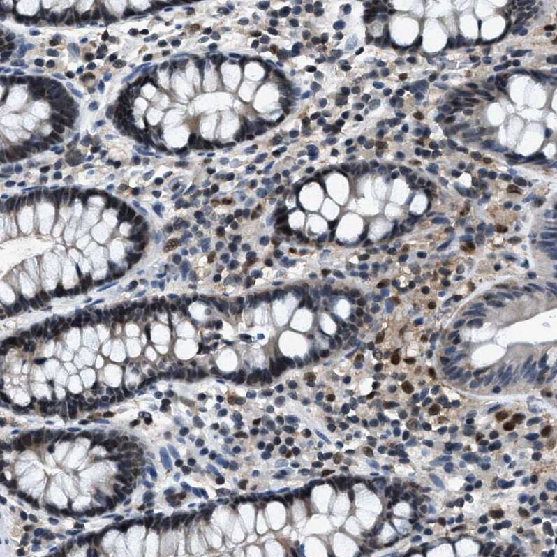 Zeta Opioid Receptor Antibody - BSA Free Immunohistochemistry: Zeta Opioid Receptor Antibody - BSA Free [NBP1-90340]