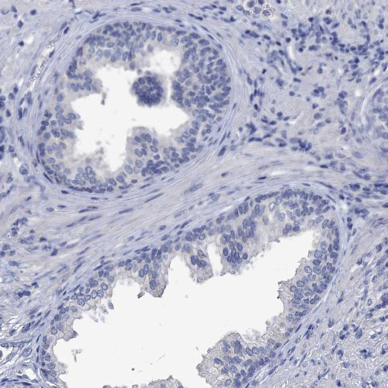 beta-Synuclein Antibody - BSA Free Immunohistochemistry: beta-Synuclein Antibody - BSA Free [NBP1-90342]