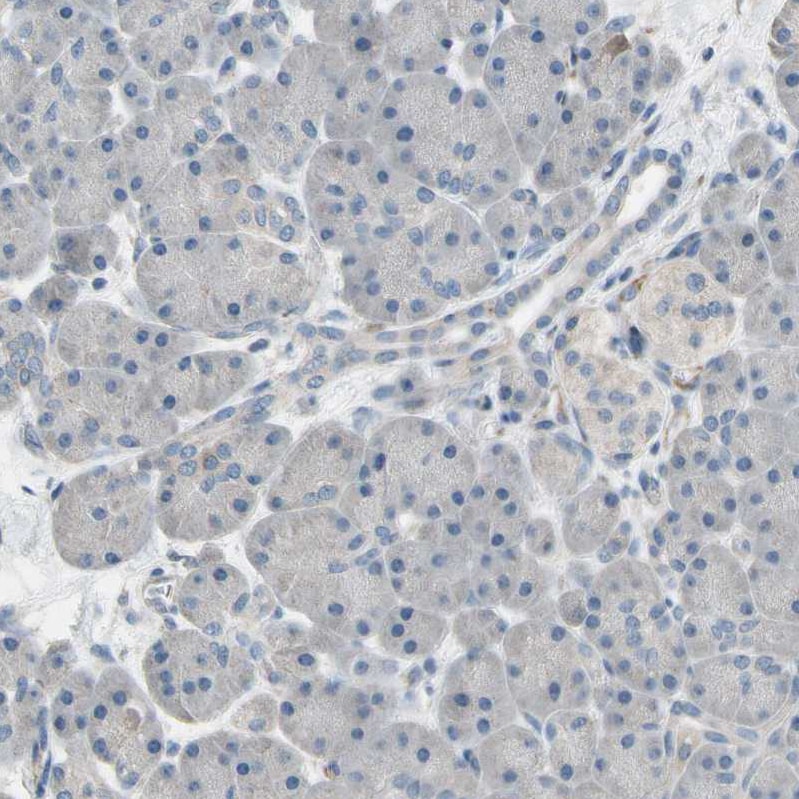 Cadherin-6/KCAD Antibody - BSA Free Immunohistochemistry: Cadherin-6/KCAD Antibody - BSA Free [NBP1-90347]