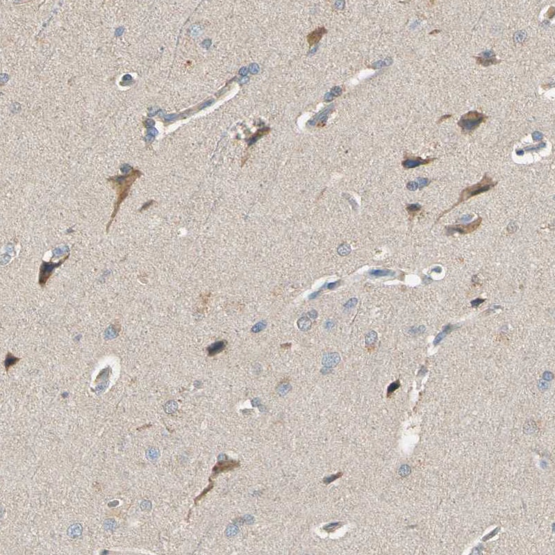 Cadherin-6/KCAD Antibody - BSA Free Immunohistochemistry: Cadherin-6/KCAD Antibody - BSA Free [NBP1-90347]