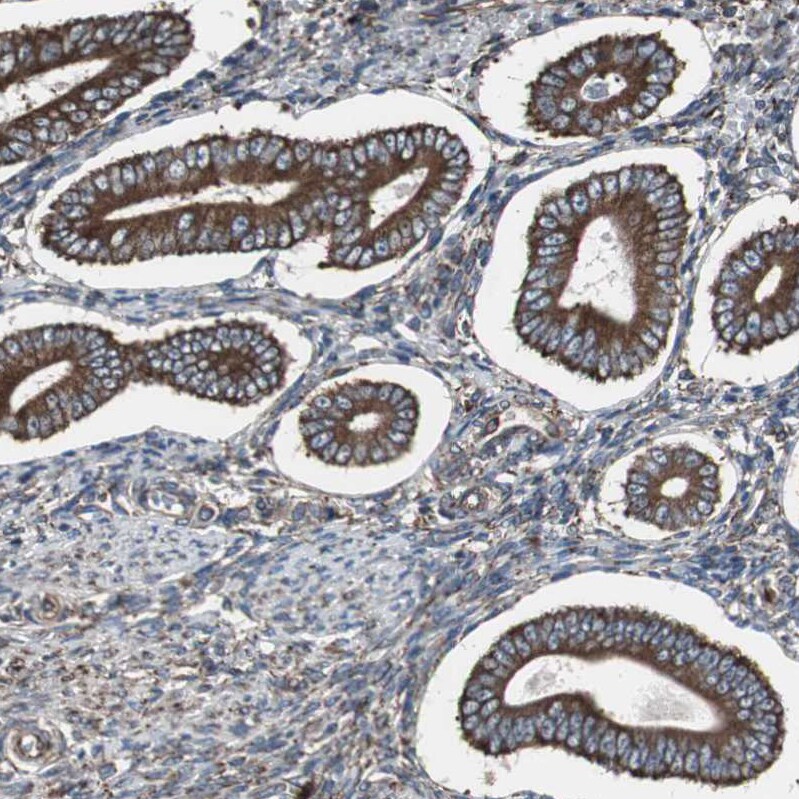 Calumenin Antibody - BSA Free Immunohistochemistry: Calumenin Antibody - BSA Free [NBP1-90348]