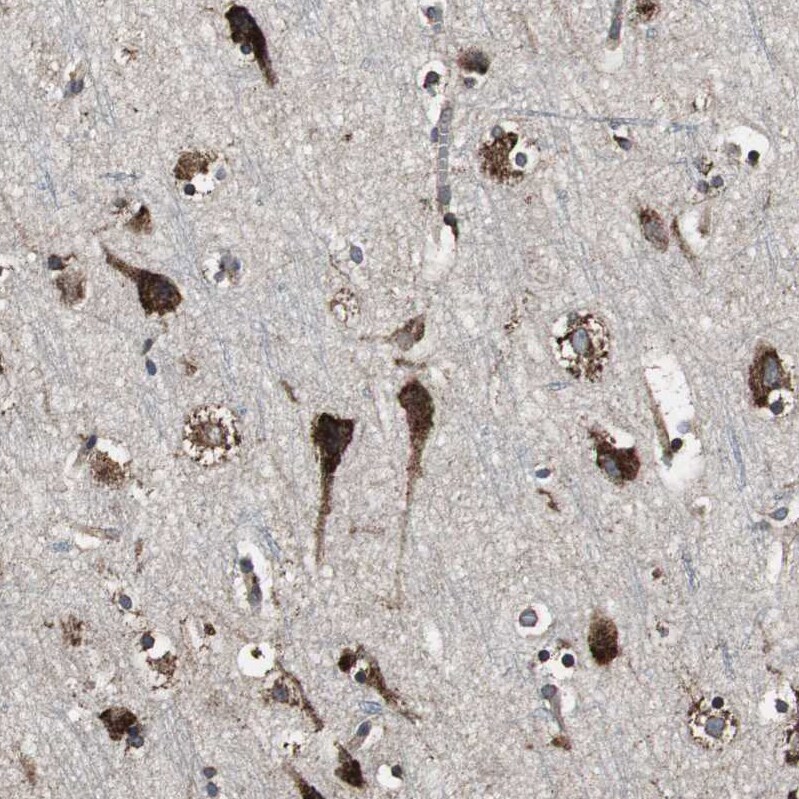 Calumenin Antibody - BSA Free Immunohistochemistry: Calumenin Antibody - BSA Free [NBP1-90348]