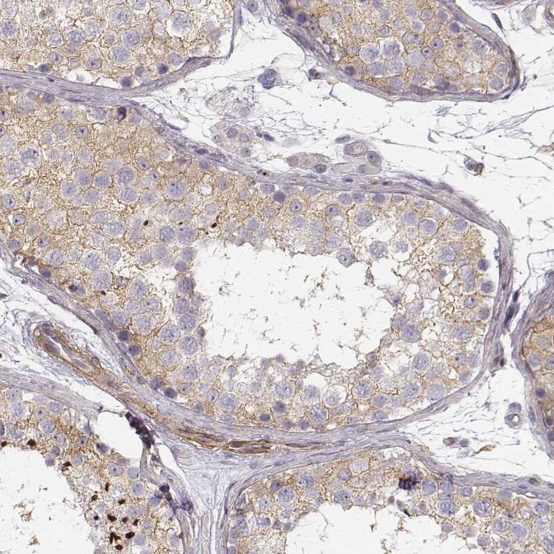 Zyxin Antibody - BSA Free Immunohistochemistry: Zyxin Antibody - BSA Free [NBP1-90349]