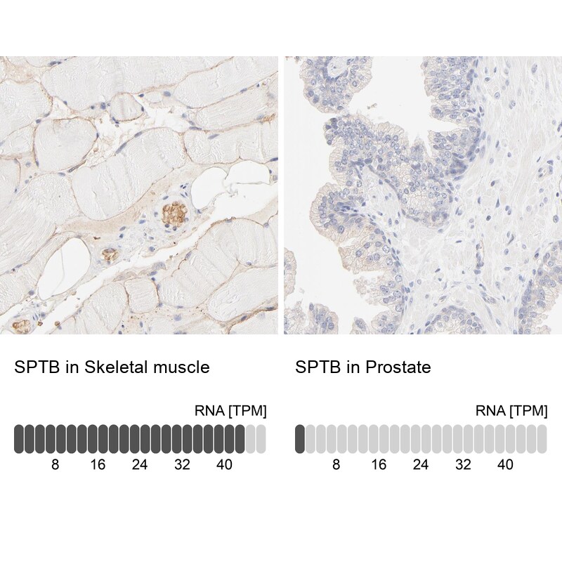 Spectrin beta 1 Antibody - BSA Free Immunohistochemistry: Spectrin beta 1 Antibody - BSA Free [NBP1-90350]