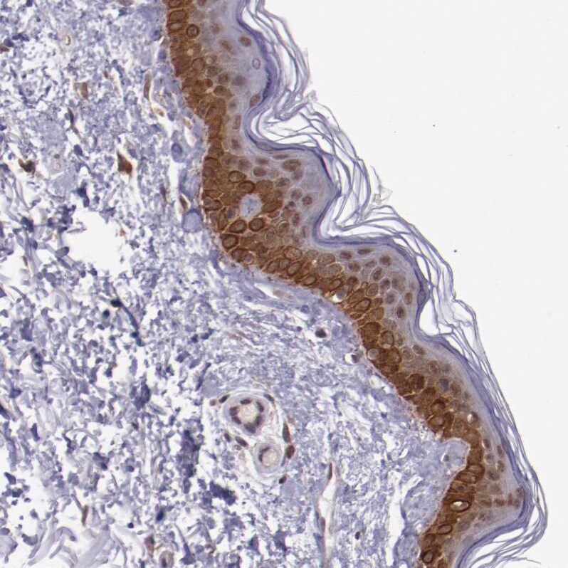 E74 like factor 1 Antibody - BSA Free Immunohistochemistry: E74 like factor 1 Antibody - BSA Free [NBP1-90352]