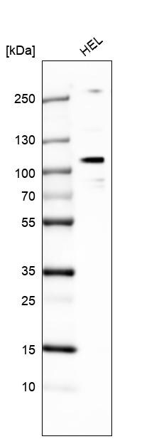 E74 like factor 1 Antibody - BSA Free Western Blot: E74 like factor 1 Antibody - BSA Free [NBP1-90352]
