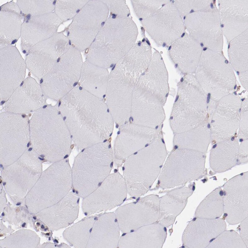E74 like factor 1 Antibody - BSA Free Immunohistochemistry: E74 like factor 1 Antibody - BSA Free [NBP1-90352]