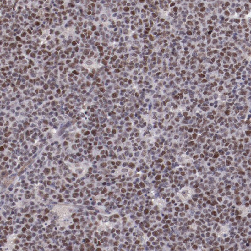 E74 like factor 1 Antibody - BSA Free Immunohistochemistry: E74 like factor 1 Antibody - BSA Free [NBP1-90352]