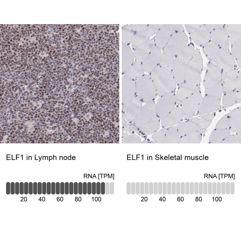 E74 like factor 1 Antibody - BSA Free Immunohistochemistry: E74 like factor 1 Antibody - BSA Free [NBP1-90352]