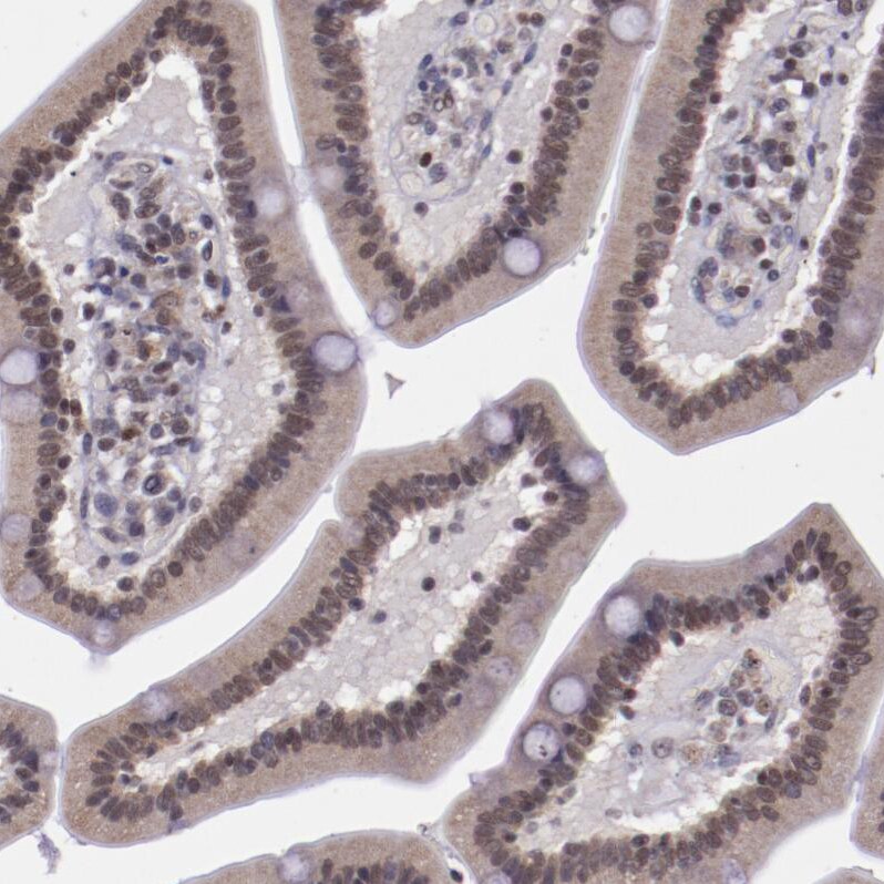 E74 like factor 1 Antibody - BSA Free Immunohistochemistry: E74 like factor 1 Antibody - BSA Free [NBP1-90352]