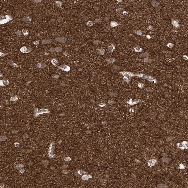 Gemin 5 Antibody - BSA Free Immunohistochemistry: Gemin 5 Antibody - BSA Free [NBP1-90354]